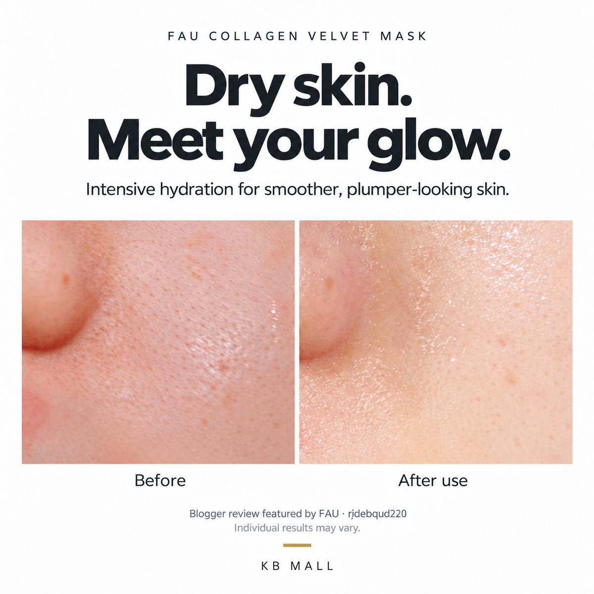 Customer cheek photos before and after using FAU Collagen Velvet Mask, featured in a hydration review. Individual results vary.