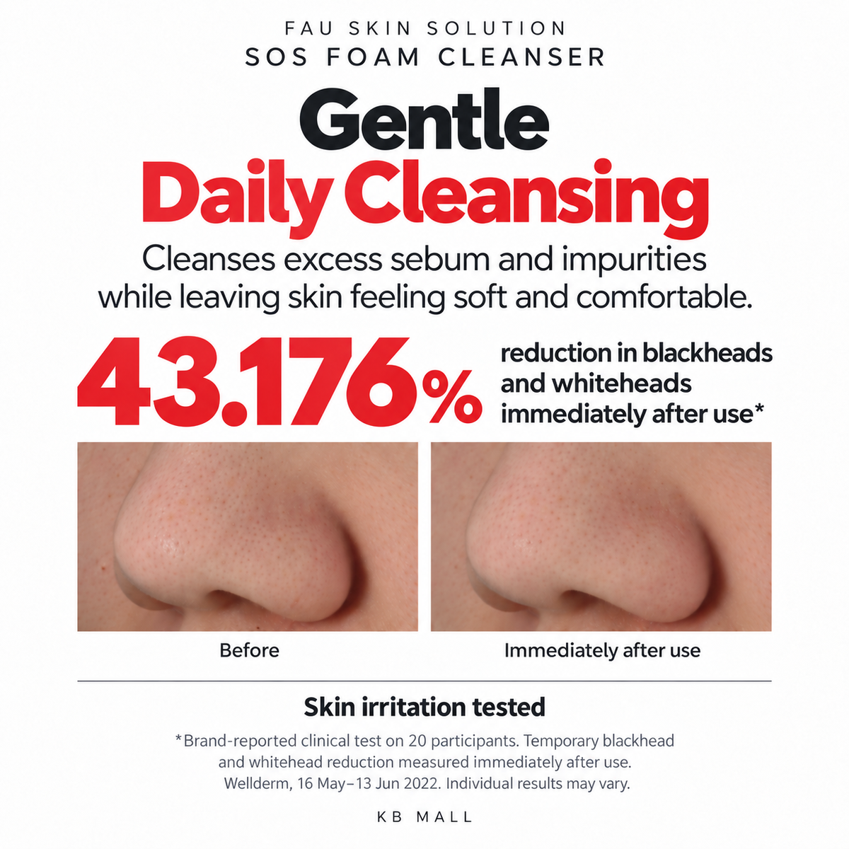 FAU Skin Solution SOS Foam Cleanser before-and-after nose comparison, with brand-reported temporary blackhead and whitehead reduction immediately after use.